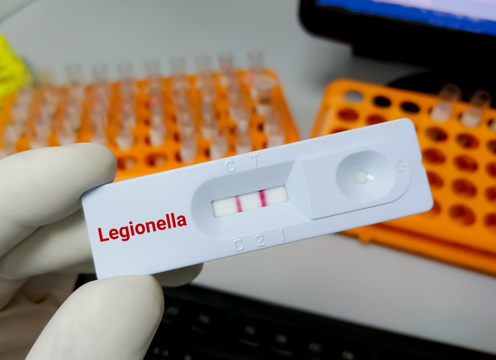 Tratamiento para la Legionella